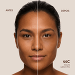 44C